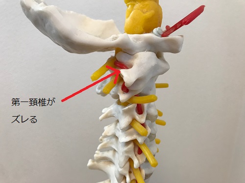 頚椎の施術
