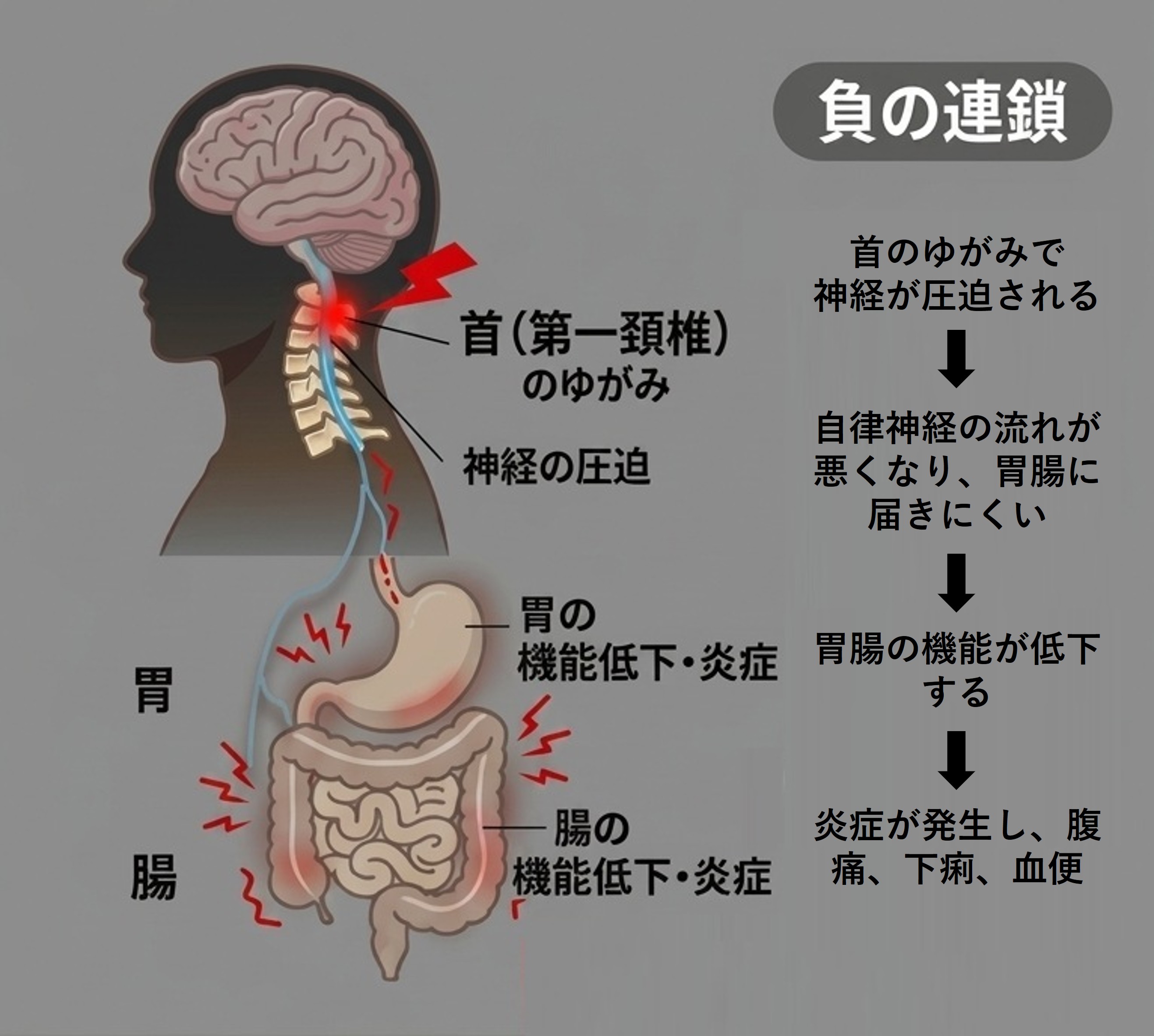 負の連鎖：首のゆがみから胃腸の不調まで