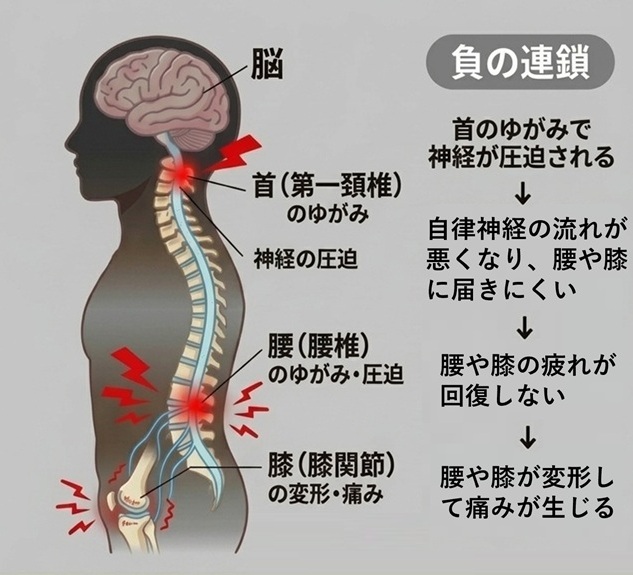 腰や膝の痛みの原因