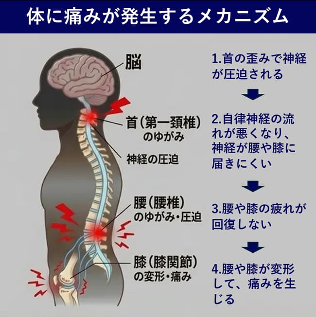 体に痛みが発生するメカニズム