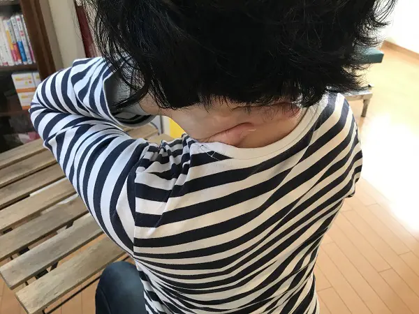 ストレートネックの施術で首の痛みを改善