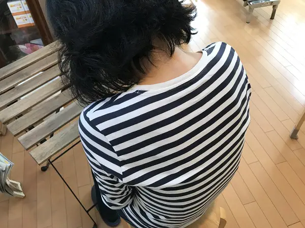 猫背矯正の施術