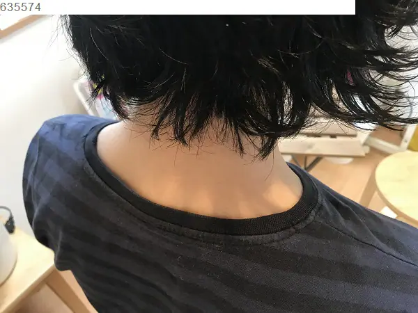 ストレートネックが様々な痛みを引き起こす