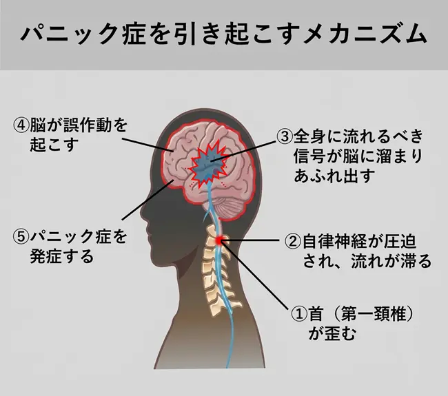 パニック症を引き起こすメカニズム
