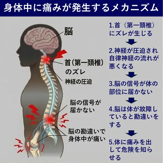 線維筋痛症で身体中に痛みが発生するメカニズム